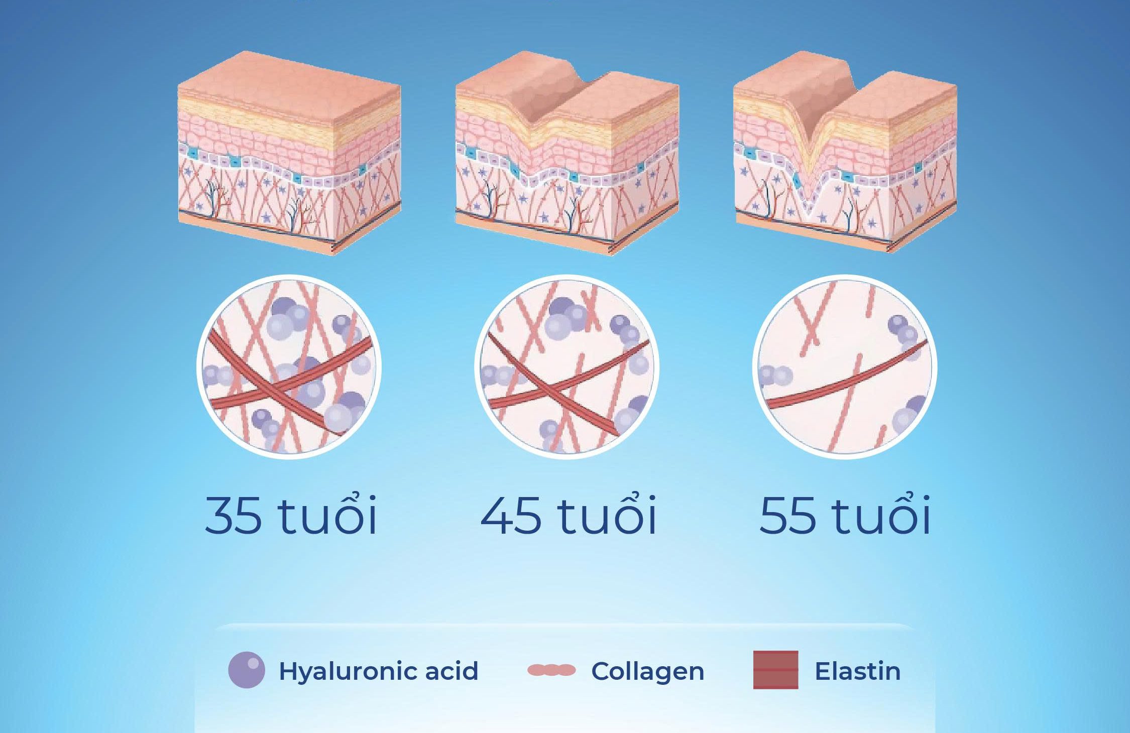 Collagen trong cấu trúc da giảm dần theo độ tuổi làm da xuất hiện nếp nhăn